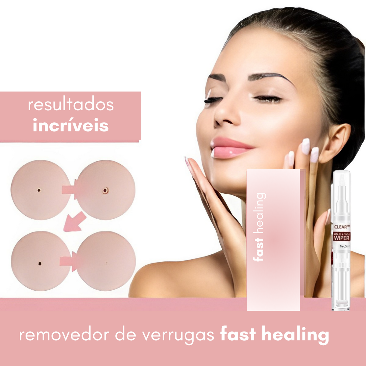 Creme Removedor de Verrugas – Fast Healing