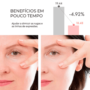 Creme Rejuvenescedor Anti-Age - Anti Manchas & Expressões™